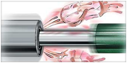 Can New Oil Cause Seal Leaks?